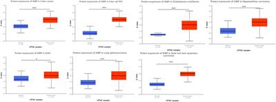 I kappa B kinase interacting protein as a promising biomarker in pan-cancer: A multi-omics analysis